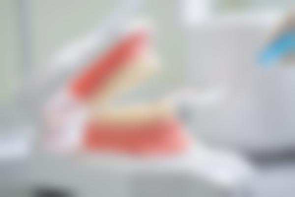 洗牙到底有没有必要？看完这篇你就明白了