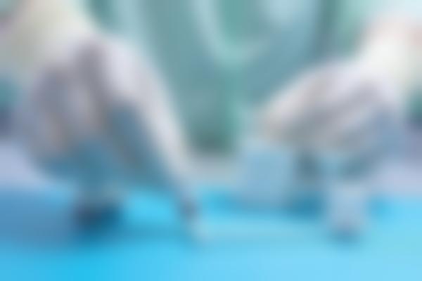 洗牙到底有没有必要？一次舒适的洗牙经历告诉你答案