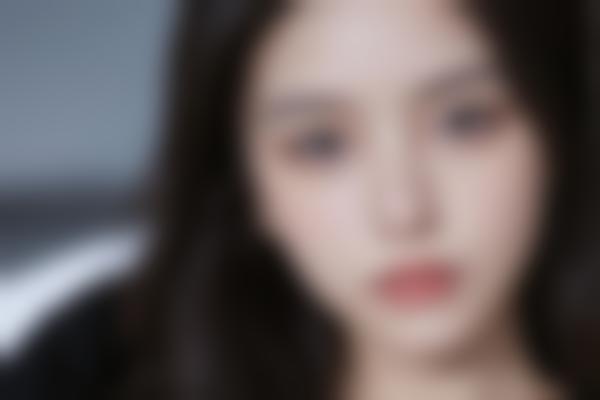 湖北荆州汇美医疗美容：幼态脸塑造，定制你的自然美