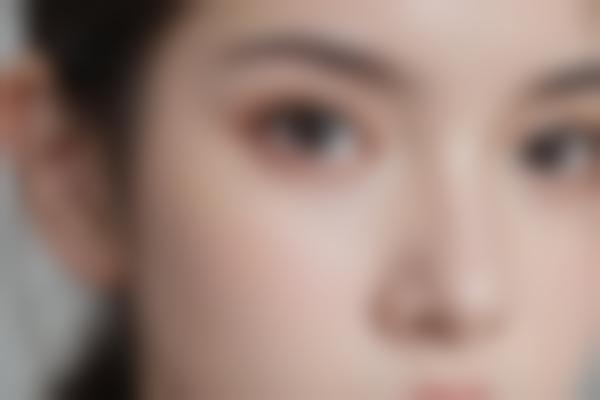 北京张云林医生抗衰修复技术怎么样？自然美学注射+光电抗衰真实测评！