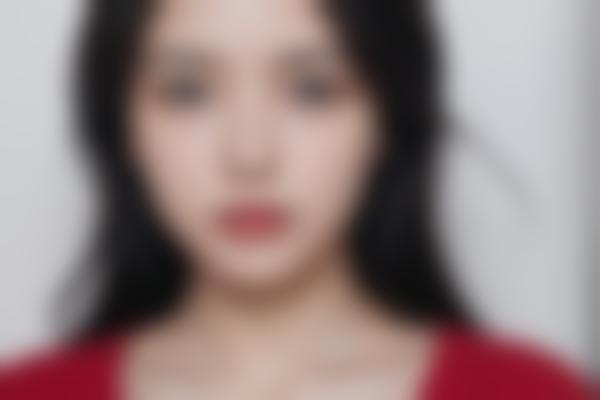 4、术后指导细致