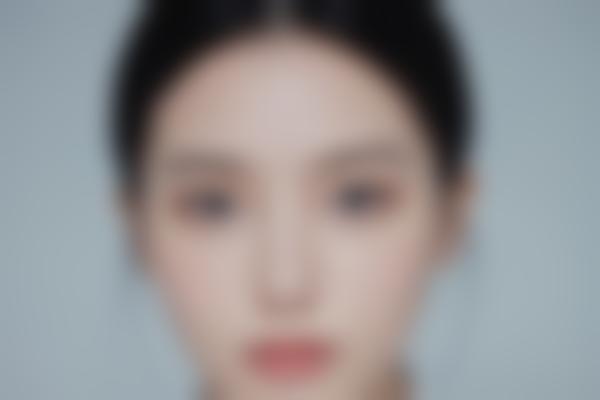 李婷医生技术优势解析