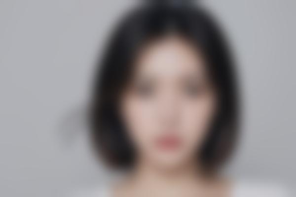 曹阳医生眼部整形修复主要项目