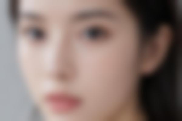 玻尿酸自然度高