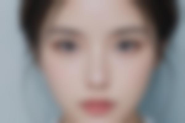 曾宁医生鼻综合三大核心优势