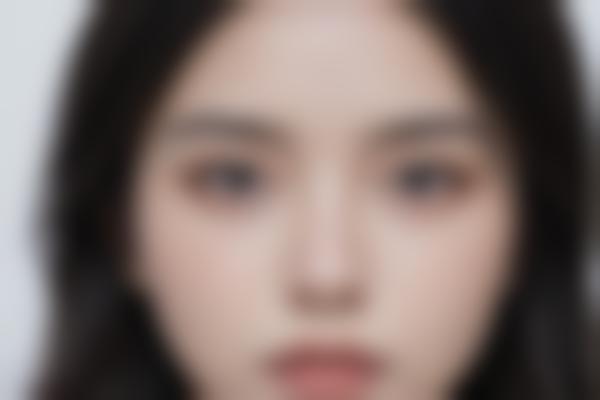 付俊俐医生做鼻子和眼睛多少钱？