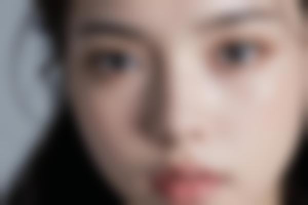 秦皇岛孙大山吸脂好，孙大山医生吸脂瘦腹瘦腿价格透明自然！