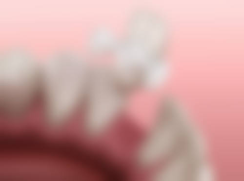 齐鲁医院口腔科收费标准大揭秘！补牙、种牙、矫正等项目价格全知晓