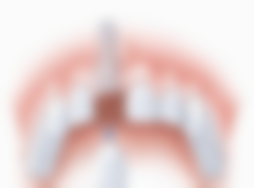 不建议使用瑞士士卓曼种植牙的人群