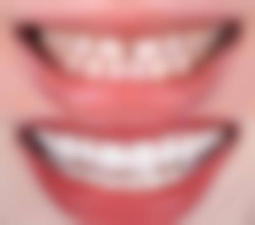 四、临沂市佳美口腔门诊部特色项目