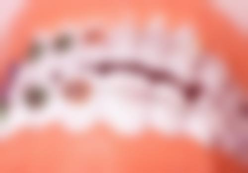 五、北京悦牙口腔石浩天医生技术怎么样？