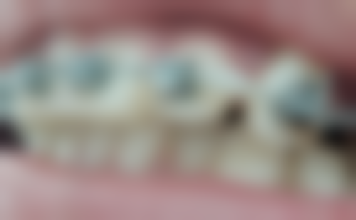 刘金龙医生技术怎么样？