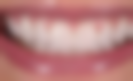 二、北京佳美口腔吴建伟医生擅长项目