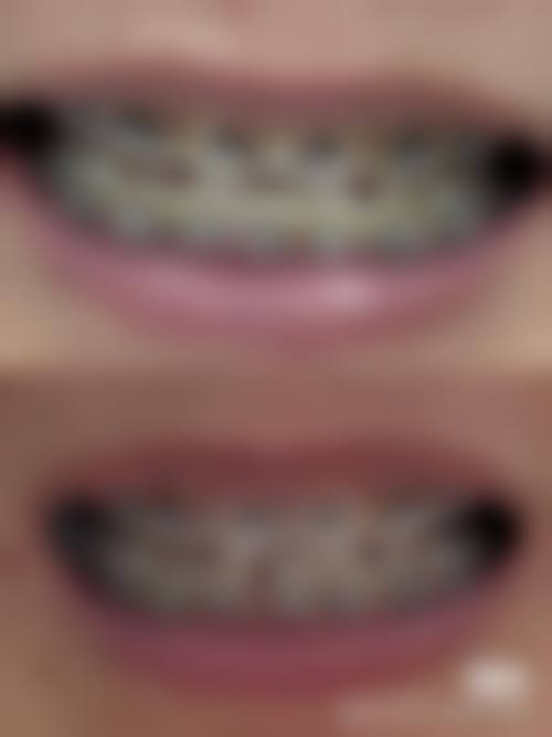 五、苏州安利口腔收费价格表