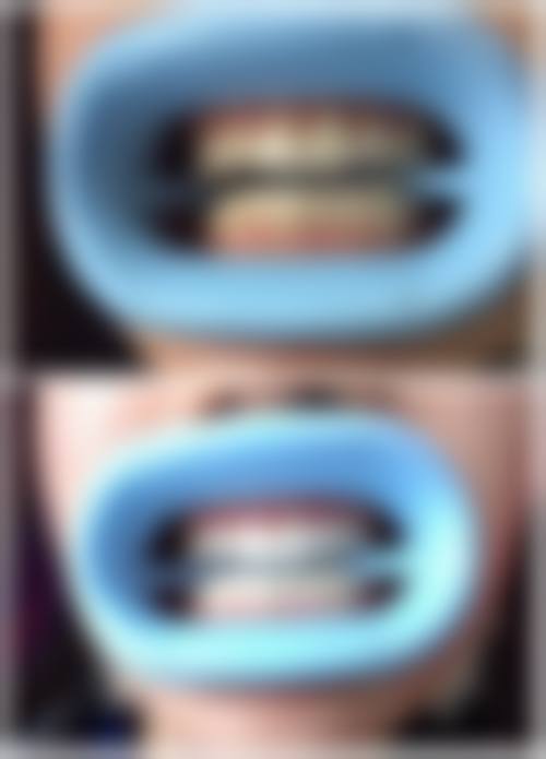 四、陕西西安美诺口腔特色项目