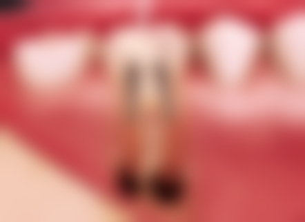 六、北川县永昌镇冠齿口腔诊所口碑如何？