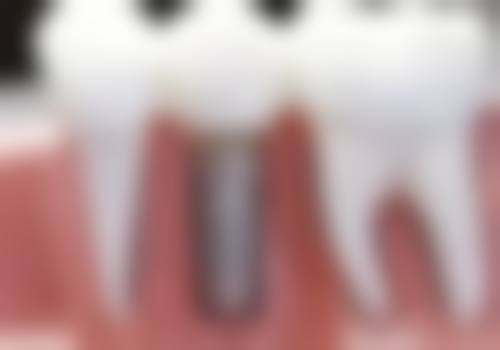 六、广东东莞优思口腔口碑如何？