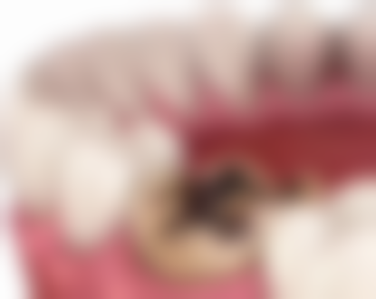 超声波洗牙会传染吗？正规机构风险极低，非正规或操作不规范有风险，患者自身也需注意！ 