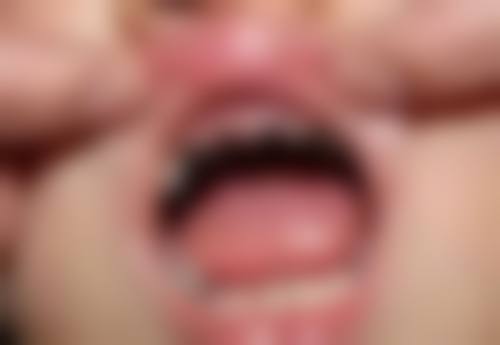 哺乳期妈妈可以洗牙吗？答案是可以，但要产后3个月且注意多项事项，保障母婴健康！ 