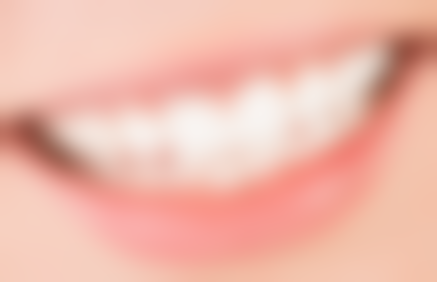 拔牙以后能吃辣的吗？辣椒对拔牙创口的影响