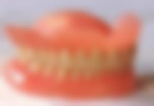 种植牙寿命的常见情况