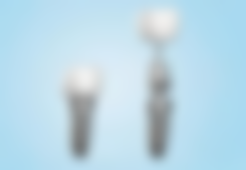 补牙和拔牙的选择原则