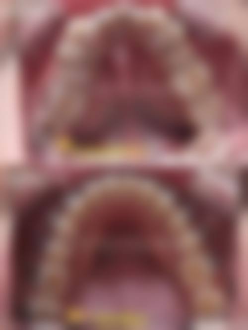 四、黔西毕节金伯士口腔门诊部特色项目