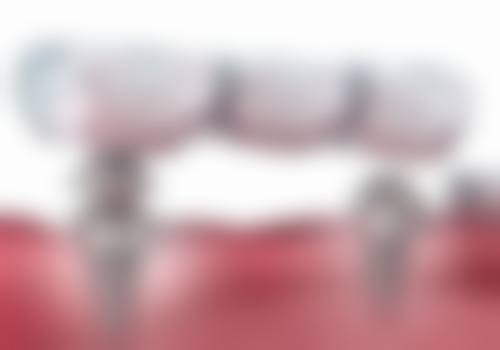 八、东莞翁生口腔怎么预约？