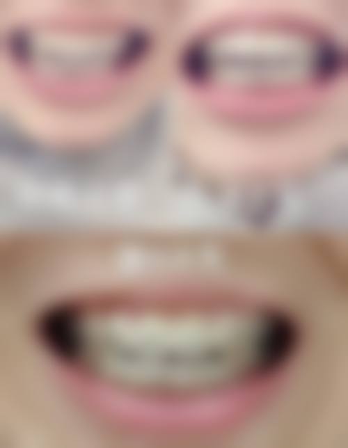 八、深圳杨俊口腔诊所怎么预约？