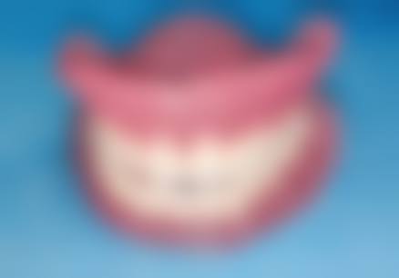 五、吉林精工口腔杨沐医生技术怎么样？