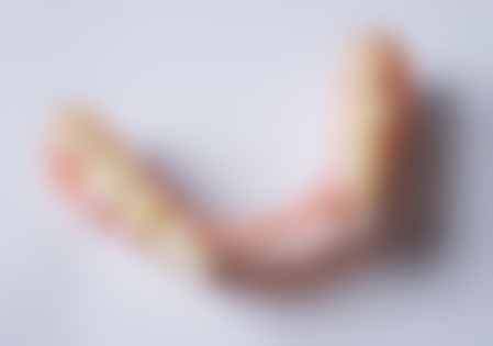 拔牙后周围的牙龈肿痛该如何缓解？