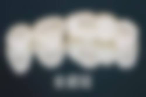 补牙洞怎么补视频全过程——第三步：消毒处理