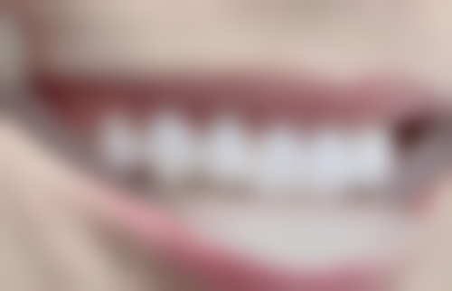 六、北京泰康拜博口腔东城董泽元医生口碑评价及真人实例反馈