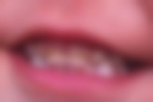 六、北京泰康拜博口腔东城任世超医生口碑评价及真人实例反馈