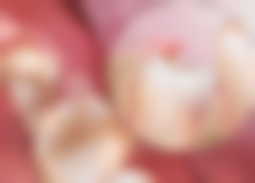 刘育文医生擅长项目