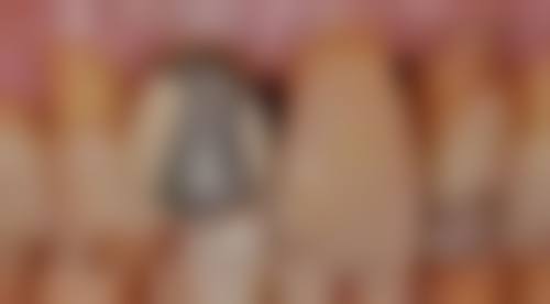 四、张家港珂润口腔诊所特色项目