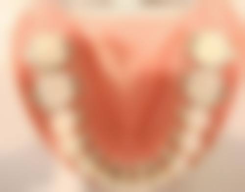 补牙洞怎么补视频全过程——第四步：填充修复