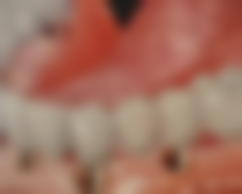 五、湖南长沙雨花佐美口腔收费价格表