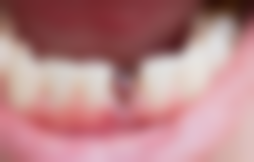 二、莆田荔城君正口腔门诊部正规吗？来看医院资质信息