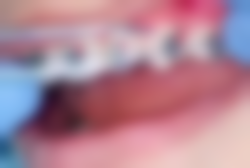 七、北京泰康拜博口腔东城刘作强医生怎么预约？