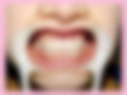 五、北京惠美京鲲口腔诊所收费价格表