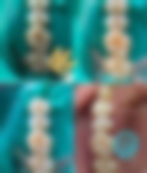 四、菏泽曹州口腔(万达店)特色项目