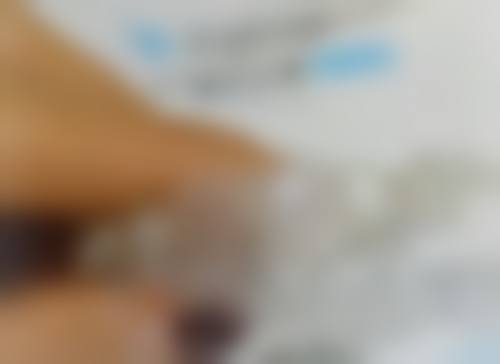 烤瓷牙什么材质比较好——金属烤瓷牙的优势与不足