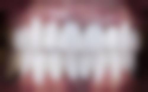 五、山东德州乐陵雅美口腔收费价格表