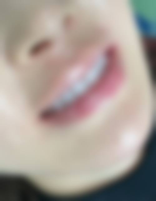 四、怀集县口腔医院特色项目