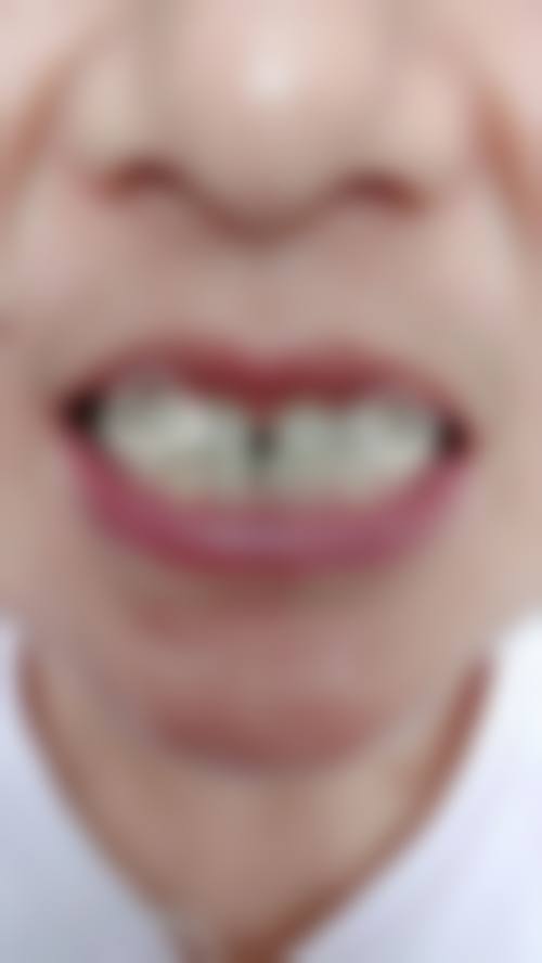 五、广州博爱口腔收费价格表