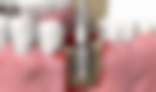 八、重庆开州精琢口腔怎么预约？