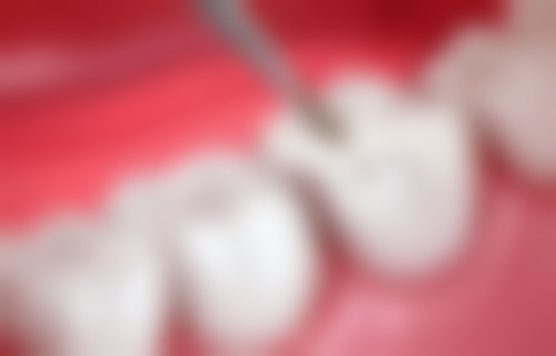 五、福州齐乐口腔门诊部收费价格表