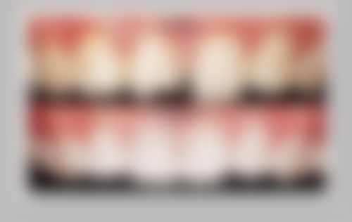 影响修复时间的因素