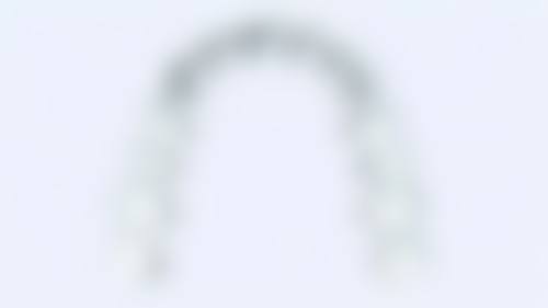 四、山东潍坊迎旭口腔特色项目